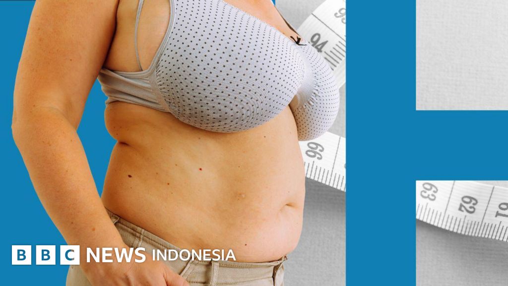 Zgodbe žensk, ki imajo zdravstvene težave zaradi velikih prsi